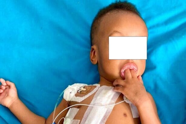 La piccola Adonai del Burundi operata al cuore a Taormina è fuori pericolo La storia della piccola Adonai del Burundi, operata con successo al cuore presso la cardiochirurgia pediatrica di Taormina