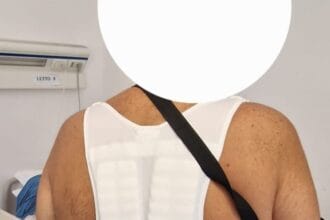 Aveva fatto accesso al Pronto Soccorso dell’ospedale di Partinico lamentando un generico senso di malessere e palpitazioni. Ma la rapidità e l’accuratezza degli accertamenti clinici hanno consentito ai medici dell’area di Emergenza, e successivamente a quelli della UOC di Cardiologia, di diagnosticare una grave patologia cardiaca fino a quel momento sconosciuta al paziente, un giovane di 27 anni.