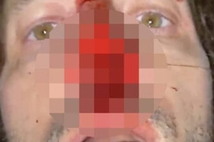 Doveva essere un tranquillo pomeriggio di sport in attesa che la città completasse una nuova opera pubblica, si è trasformato in un incubo di violenza gratuita. Domenica pomeriggio, nella zona di Bonagia a Palermo, un branco composto da sette giovani ha accerchiato e aggredito tre persone nei pressi del cantiere del futuro skate park di via Guido Rossa.